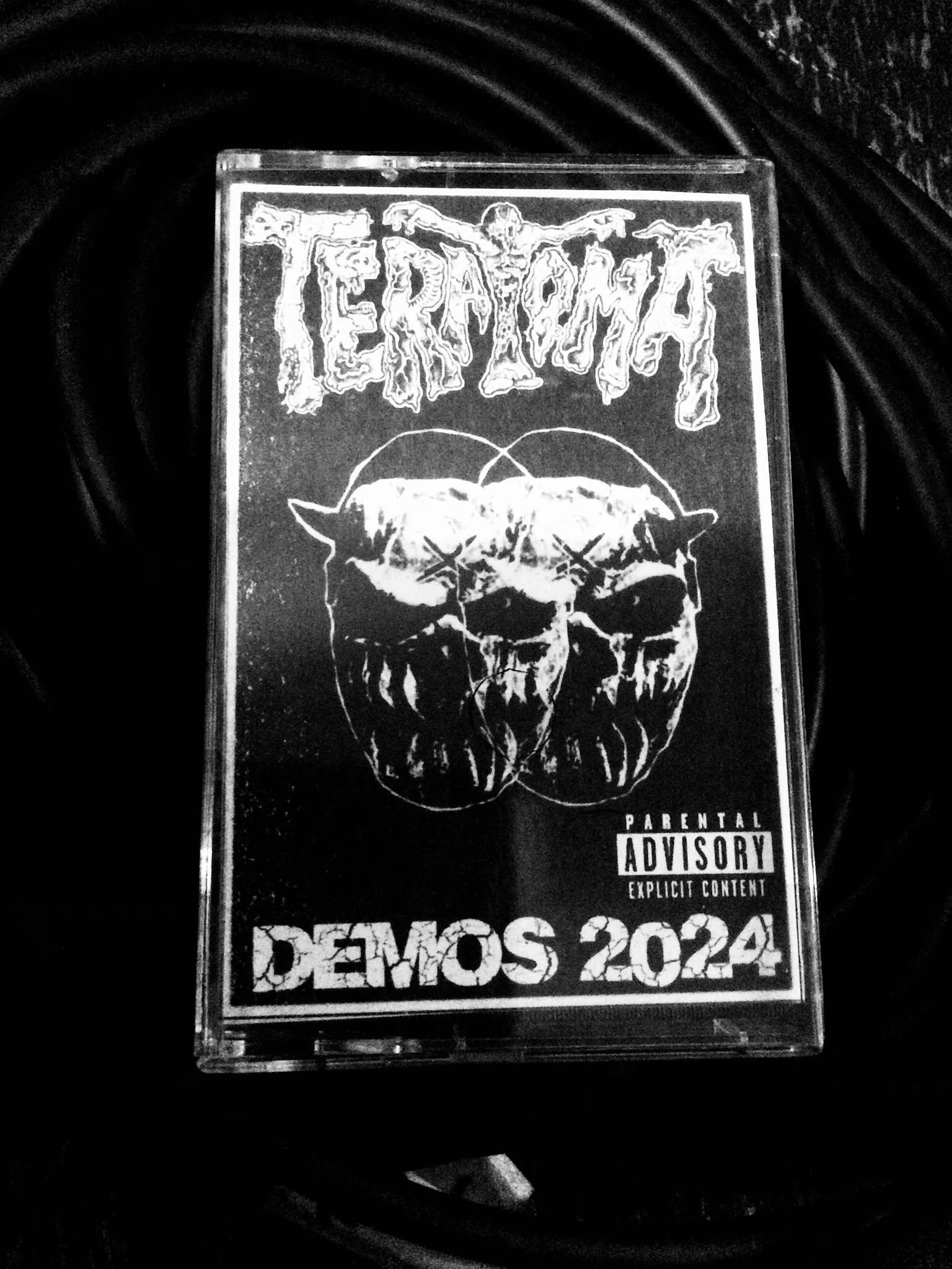 DEMOS 2024] Cassette Tape — TERATOMABAND.COM